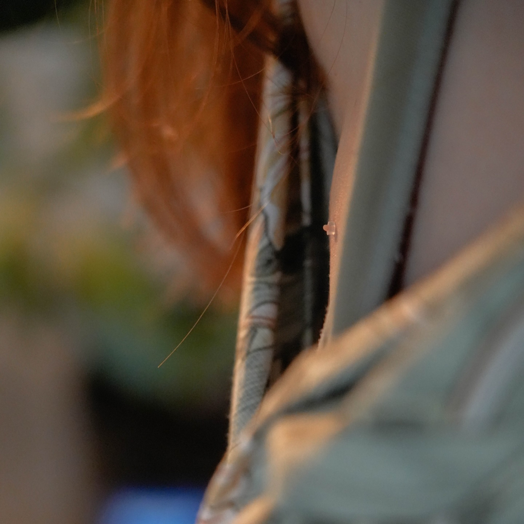 Caneta Removedora de Verrugas